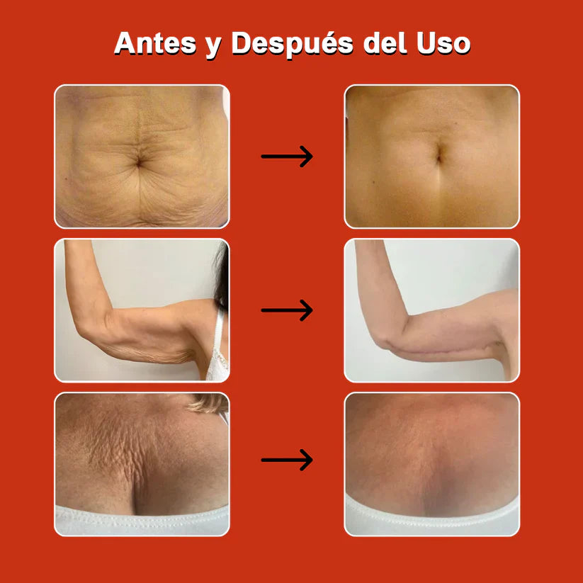 Aceite Mágico Anticelulitis 100