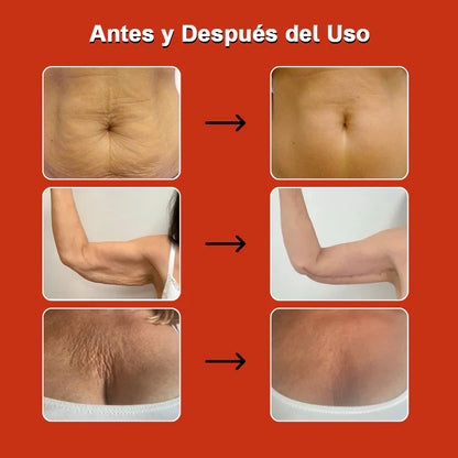 Aceite Mágico Anticelulitis 100