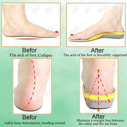 Premium Orthotic Gel Insoles Orthopedic Flat Foot Health Sole Pad For Shoes Insert Arch Support Pad For Plantar fasciitis Unisex